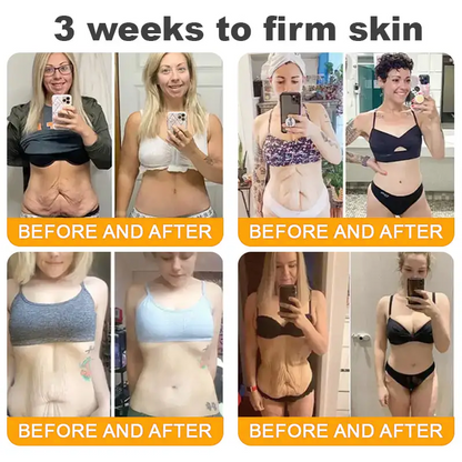 LOVILDS™ Bee Venom Cream – 🌸 Anti-Aging, Hydrating & Skin Repair